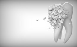 Comment lutter efficacement contre la sensibilité dentaire ?